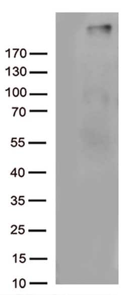 C4B Monoclonal Antibody (OTI1B2), TrueMAB , OriGene 30 &mu;L; Unconjugated:Antibodies,