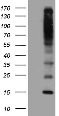 C5orf56 Monoclonal Antibody (OTI10A6), TrueMAB , OriGene 30 &mu;L; Unconjugated:Antibodies,