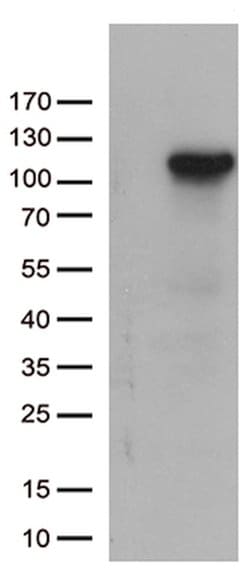 C6 Mouse anti-Human, Clone: OTI1E2, lyophilized, TrueMAB 100 &mu;g; Unconjugated:Antibodies,