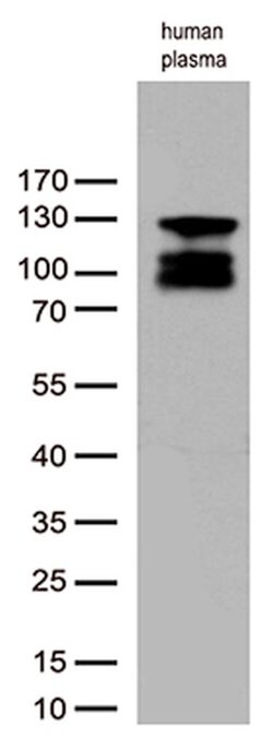 C6 Mouse anti-Human, Clone: OTI1E2, lyophilized, TrueMAB 100 &mu;g; Unconjugated:Antibodies,