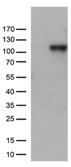 C6 Mouse anti-Human, Clone: OTI1H4, lyophilized, TrueMAB 100 &mu;g; Unconjugated:Antibodies,