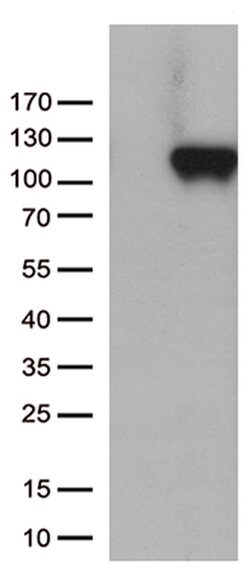 C6 Monoclonal Antibody (OTI2G1), TrueMAB , OriGene:Antibodies:Primary Antibodies