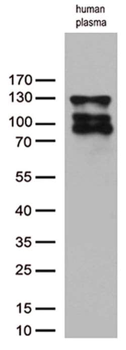 C6 Monoclonal Antibody (OTI2B9), TrueMAB , OriGene 100 &mu;L; Unconjugated:Antibodies,