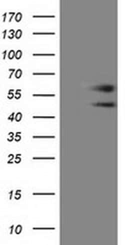 C9orf41 Monoclonal Antibody (OTI4A2), TrueMAB , OriGene 100 &mu;L; Unconjugated:Antibodies,