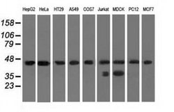 C9orf41 Monoclonal Antibody (OTI4A2), TrueMAB , OriGene 100 &mu;L; Unconjugated:Antibodies,