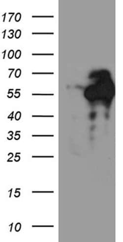 C9orf43 Monoclonal Antibody (OTI4F9), TrueMAB , OriGene 100 &mu;L; Unconjugated:Antibodies,