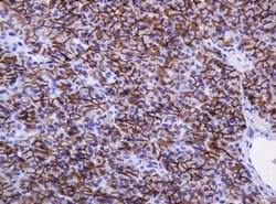CA12 Mouse anti-Human, Clone: OTI2C6, lyophilized, TrueMAB 100 &mu;g; Unconjugated:Antibodies,