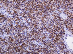 CA12 Mouse anti-Human, Clone: OTI2C6, liquid, TrueMAB 30 &mu;L; Unconjugated:Antibodies,