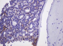CA12 Mouse anti-Human, Clone: OTI2C6, lyophilized, TrueMAB 100 &mu;g; Unconjugated:Antibodies,