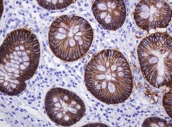 CA12 Mouse anti-Human, Clone: OTI2C6, lyophilized, TrueMAB 100 &mu;g; Unconjugated:Antibodies,