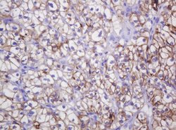 CA12 Mouse anti-Human, Clone: OTI2C6, lyophilized, TrueMAB 100 &mu;g; Unconjugated:Antibodies,