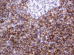 CA12 Mouse anti-Human, Clone: OTI4G3, lyophilized, TrueMAB 100 &mu;g; Unconjugated:Antibodies,