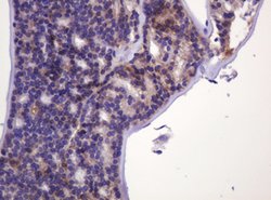CA12 Mouse anti-Human, Clone: OTI4G3, lyophilized, TrueMAB 100 &mu;g; Unconjugated:Antibodies,