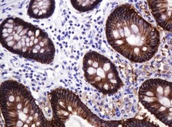 CA12 Mouse anti-Human, Clone: OTI4G3, lyophilized, TrueMAB 100 &mu;g; Unconjugated:Antibodies,