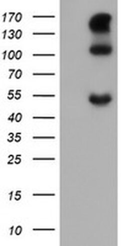 CA12 Monoclonal Antibody (OTI2E9), TrueMAB , OriGene 100 &mu;L; Unconjugated:Antibodies,