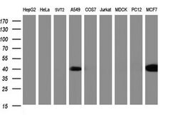 CA12 Monoclonal Antibody (OTI2E9), TrueMAB , OriGene 100 &mu;L; Unconjugated:Antibodies,