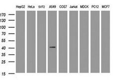 CA12 Mouse anti-Human, Clone: OTI2C6, liquid, TrueMAB 30 &mu;L; Unconjugated:Antibodies,