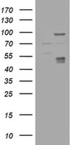 CA12 Monoclonal Antibody (OTI3F1), TrueMAB , OriGene 30 &mu;L; Unconjugated:Antibodies,