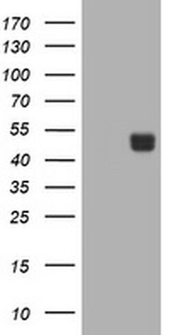CA12 Monoclonal Antibody (OTI4G3), TrueMAB , OriGene 30 &mu;L; Unconjugated:Antibodies,