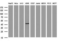 CA12 Mouse anti-Human, Clone: OTI4G3, lyophilized, TrueMAB 100 &mu;g; Unconjugated:Antibodies,