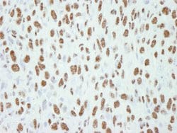 CA150 Polyclonal Antibody, Bethyl Laboratories:Antibodies:Primary Antibodies