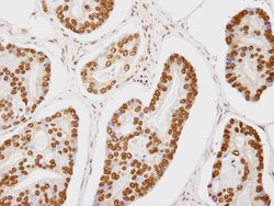 CA150 Polyclonal Antibody, Bethyl Laboratories 10 &mu;L; Unconjugated:Antibodies,