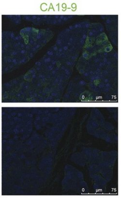 CA19-9 Mouse anti-Human, Clone: NS19-9, lyophilized, TrueMAB 100 &mu;g;