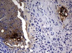 CA19-9 Mouse anti-Human, Clone: NS19-9, lyophilized, TrueMAB 100 &mu;g;