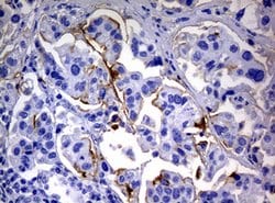 CA19-9 Mouse anti-Human, Clone: NS19-9, lyophilized, TrueMAB 100 &mu;g;
