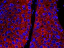 CAD Polyclonal Antibody, Bethyl Laboratories 10 &mu;L | Buy Online | Bethyl Laboratories, Inc | Fisher Scientific