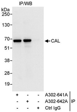 CAL Rabbit anti-Human, Polyclonal, Bethyl Laboratories 100 &mu;L; Unconjugated:Antibodies,