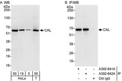 CAL Rabbit anti-Human, Polyclonal, Bethyl Laboratories 100 &mu;L; Unconjugated:Antibodies,