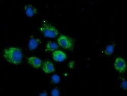 CALCOCO2 Monoclonal Antibody (OTI2D11), TrueMAB , OriGene 100 &mu;L; Unconjugated:Antibodies,