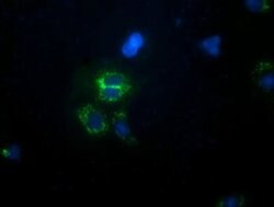 CALCOCO2 Monoclonal Antibody (OTI2C11), TrueMAB , OriGene 30 &mu;L; Unconjugated:Antibodies,