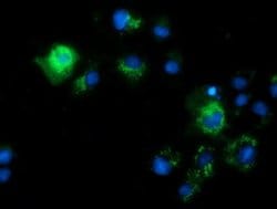 CALCOCO2 Monoclonal Antibody (OTI2B11), TrueMAB , OriGene 100 &mu;L; Unconjugated:Antibodies,
