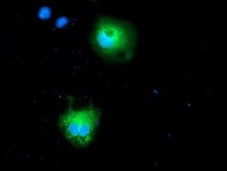 CALCOCO2 Monoclonal Antibody (OTI6E8), TrueMAB , OriGene 100 &mu;L; Unconjugated:Antibodies,