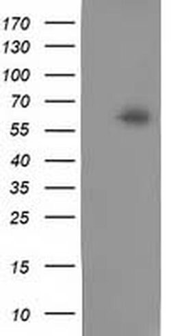 CALCOCO2 Mouse anti-Human, Clone: OTI4H5, liquid, TrueMAB 100 &mu;L; Unconjugated:Antibodies,