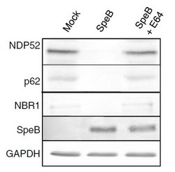 CALCOCO2 Mouse anti-Human, Clone: OTI4H5, liquid, TrueMAB 100 &mu;L; Unconjugated:Antibodies,