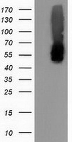CALCOCO2 Monoclonal Antibody (OTI2D11), TrueMAB , OriGene 100 &mu;L; Unconjugated:Antibodies,