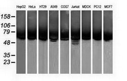 CALCOCO2 Monoclonal Antibody (OTI2D11), TrueMAB , OriGene 100 &mu;L; Unconjugated:Antibodies,