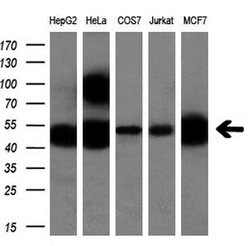 CALCOCO2 Monoclonal Antibody (OTI2B11), TrueMAB , OriGene:Antibodies:Primary
