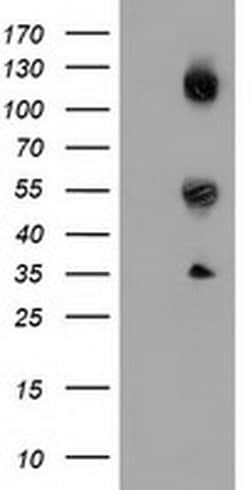 CALCOCO2 Monoclonal Antibody (OTI7A7), TrueMAB , OriGene 30 &mu;L; Unconjugated:Antibodies,