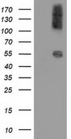 CALCOCO2 Monoclonal Antibody (OTI6E8), TrueMAB , OriGene 100 &mu;L; Unconjugated:Antibodies,