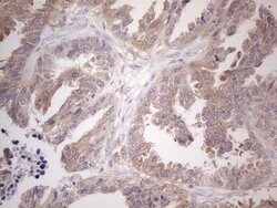 CAMK2B Mouse anti-Human, Clone: OTI8D9, lyophilized, TrueMAB 100 &mu;g;