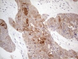 CAMK2B Mouse anti-Human, Clone: OTI8D9, lyophilized, TrueMAB 100 &mu;g;