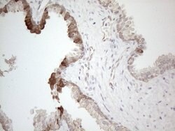 CAMK2B Mouse anti-Human, Clone: OTI8D9, lyophilized, TrueMAB 100 &mu;g;