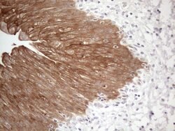 CAMK2B Mouse anti-Human, Clone: OTI8D9, lyophilized, TrueMAB 100 &mu;g;