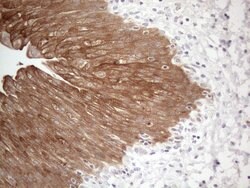 CAMK2B Monoclonal Antibody (OTI8D9), TrueMAB , OriGene 30 &mu;L | Buy Online | Origene Technologies | Fisher Scientific