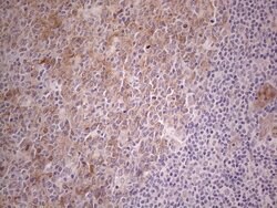 CAMK2B Mouse anti-Human, Clone: OTI8D9, lyophilized, TrueMAB 100 &mu;g;