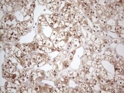 CAMK2B Mouse anti-Human, Clone: OTI8D9, lyophilized, TrueMAB 100 &mu;g;